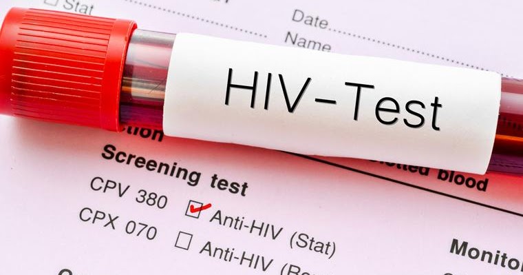 7 Signs You May Have HIV Without Knowing